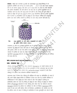 IGNOU BBYCT-131 Guess Paper Solved Hindi Medium